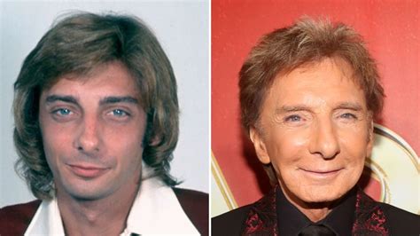 Did Barry Manilow Have Plastic Surgery? A Detailed Analysis